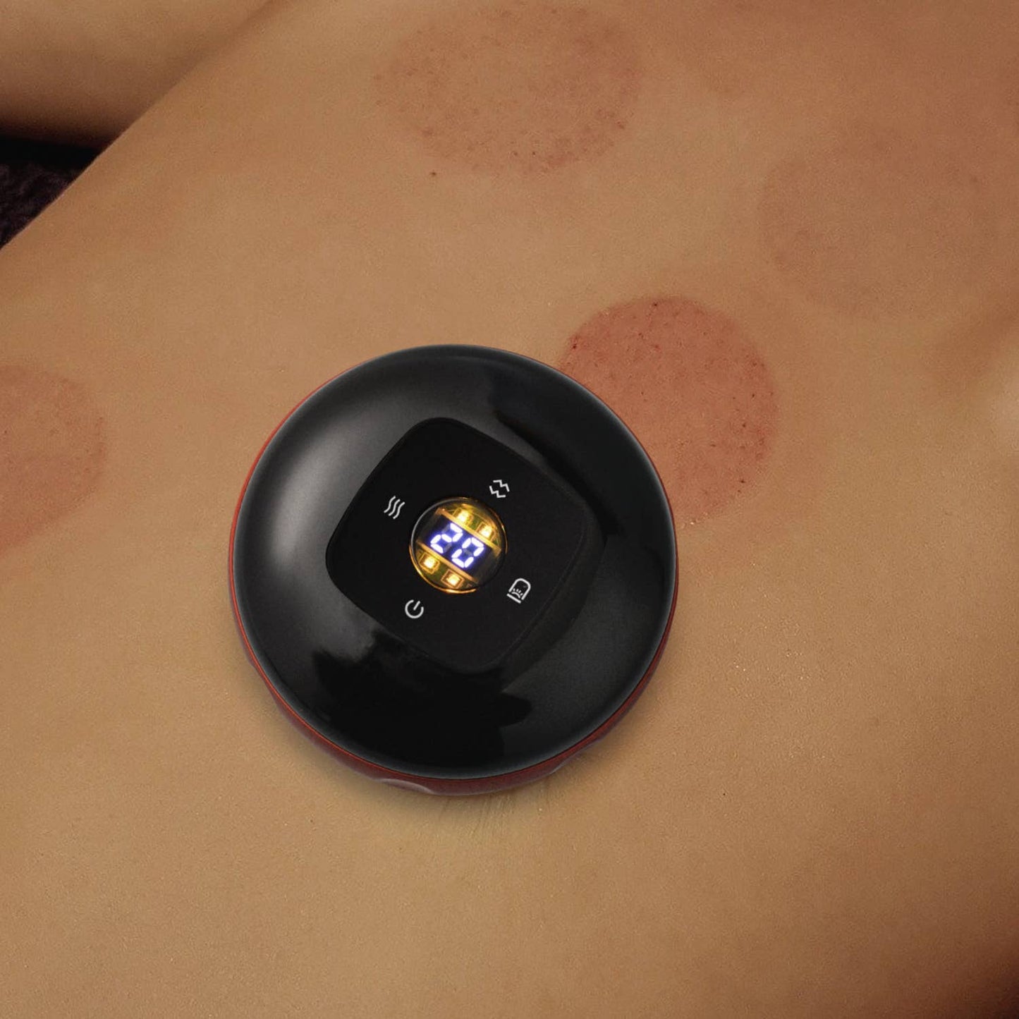 Smart Cupping Therapy Device